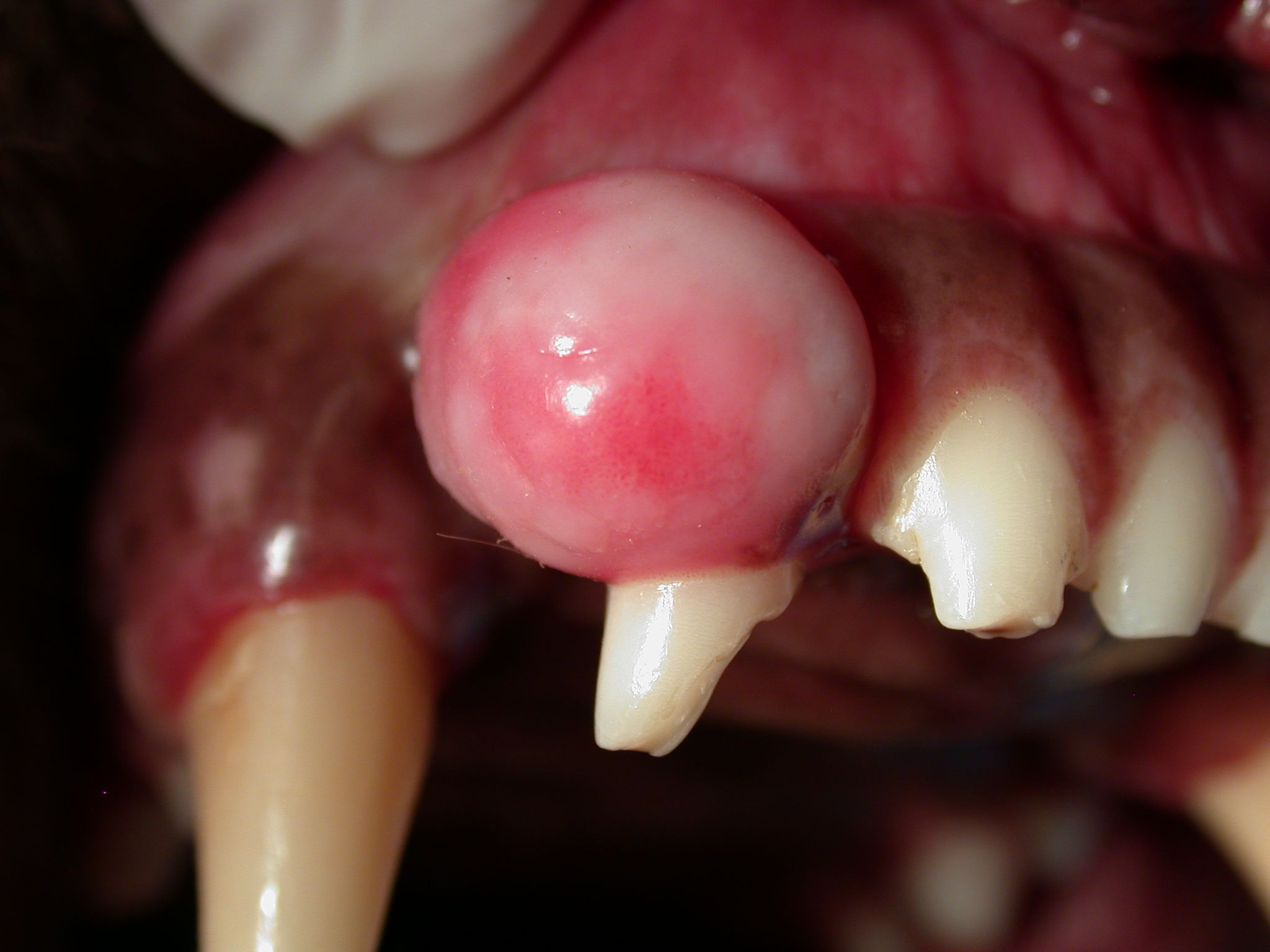 Oral tumors.