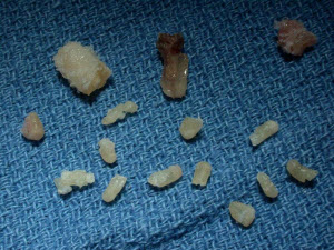 Extracted roots from Cat Teeth - Vet Dentistry