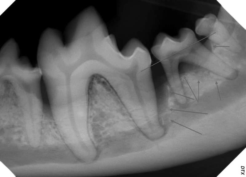 Dental radiograph of 308-311, showing severe bone loss around all of these teeth. Go back and look at this picture of this area above. The straight line shows the approximate normal bone level. The arrows show the areas of severe bone loss. This was a periodontal pocket approximately 14 mm deep! It is not possible to clean this in an unanesthetized patient.