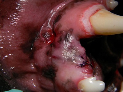 Figure 6. After extraction of 203 and partial closure of the site. An area of gingival hyperplasia on the canine tooth has been reduced and re-contoured utilizing an electrosurgical unit.