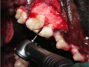 Figure 9. Appropriate exposure for sectioning and extraction of the right upper fourth premolar (#108). 