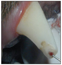 Picture of a fractured canine tooth with pulp exposure.