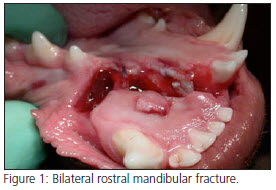 Segmental Mandibulectomy