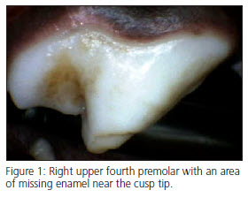 Enamel Hypocalcification in Pet Teeth - Vet Dentistry